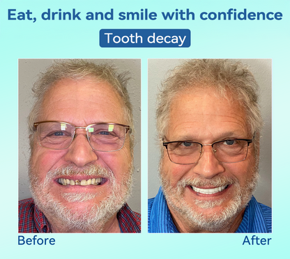 Tiworld®🍀𝐏𝐫𝐞𝐦𝐢𝐮𝐦 𝐃𝐞𝐧𝐭𝐮𝐫𝐞(🦷𝐋𝐢𝐦𝐢𝐭𝐞𝐝 𝐭𝐢𝐦𝐞 𝐝𝐢𝐬𝐜𝐨𝐮𝐧𝐭 𝐋𝐚𝐬𝐭 𝟑𝟎 𝐦𝐢𝐧𝐮𝐭𝐞𝐬🦷)