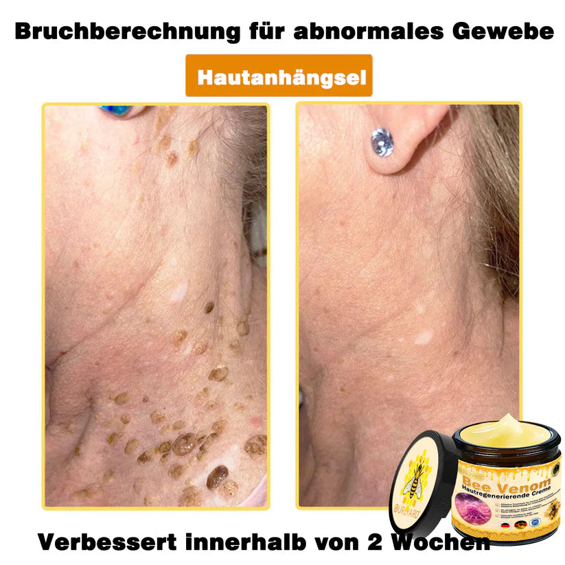 🔥Ourlyard® Bee Venom Pro Comprehensive Cream — 🔥Limited Time 80% OFF🔥