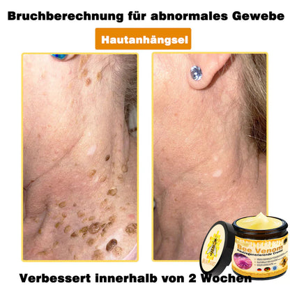 🔥Ourlyard® Bee Venom Pro Comprehensive Cream — 🔥Limited Time 80% OFF🔥