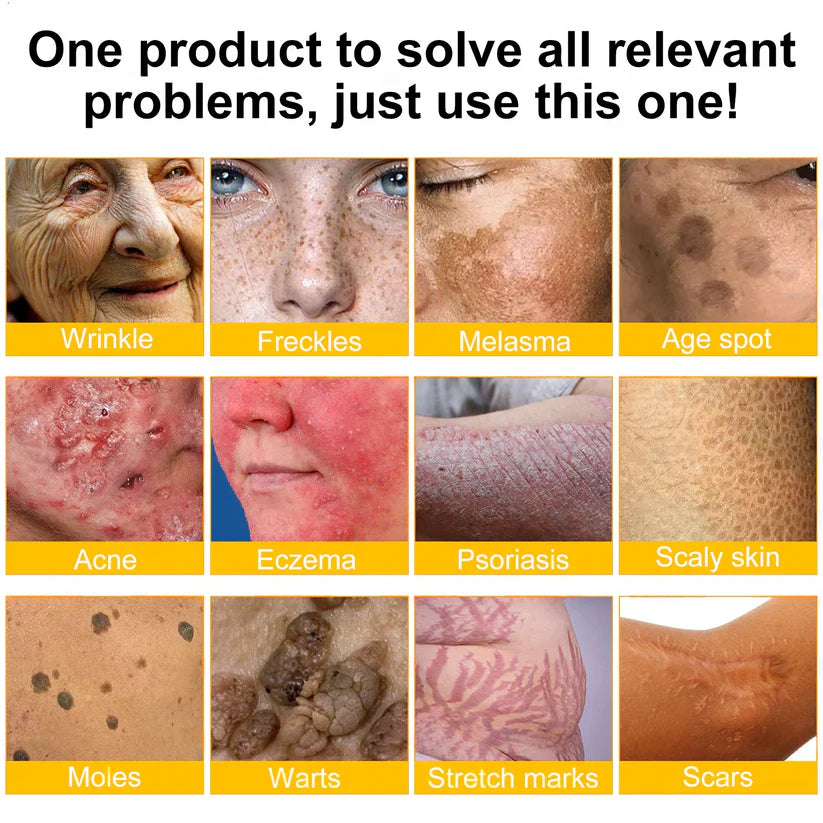 🔥Ourlyard® Bee Venom Pro Comprehensive Cream — 🔥Limited Time 80% OFF🔥