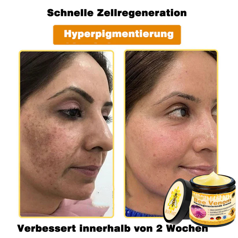 🔥Ourlyard® Bee Venom Pro Comprehensive Cream — 🔥Limited Time 80% OFF🔥