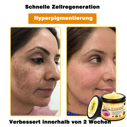 🔥Ourlyard® Bee Venom Pro Comprehensive Cream — 🔥Limited Time 80% OFF🔥