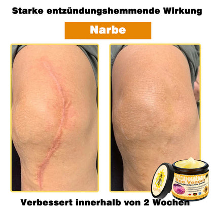 🔥Ourlyard® Bee Venom Pro Comprehensive Cream — 🔥Limited Time 80% OFF🔥