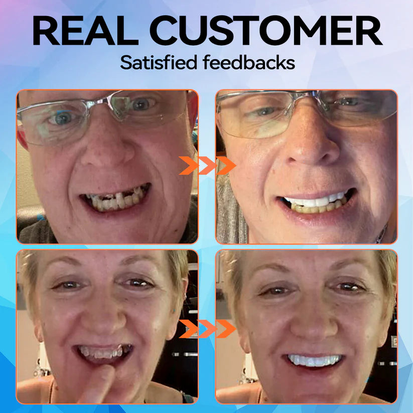 Minceetbien™🗽🗽 Silicone Reline Denture Set (⏰Limited Time 80% Off - Last 30 Minutes ⏰)