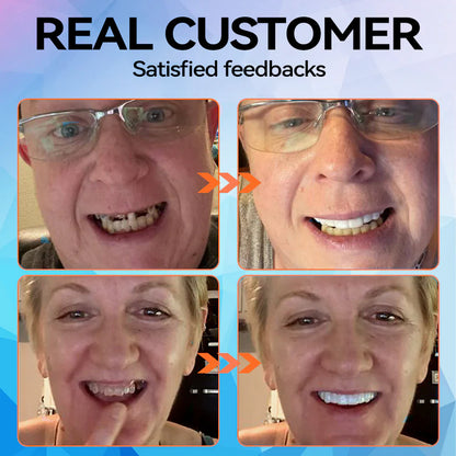 Minceetbien™🗽🗽 Silicone Reline Denture Set (⏰Limited Time 80% Off - Last 30 Minutes ⏰)