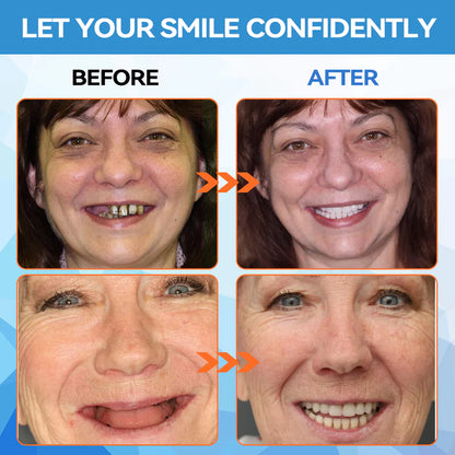 Minceetbien™🗽🗽 Silicone Reline Denture Set (⏰Limited Time 80% Off - Last 30 Minutes ⏰)