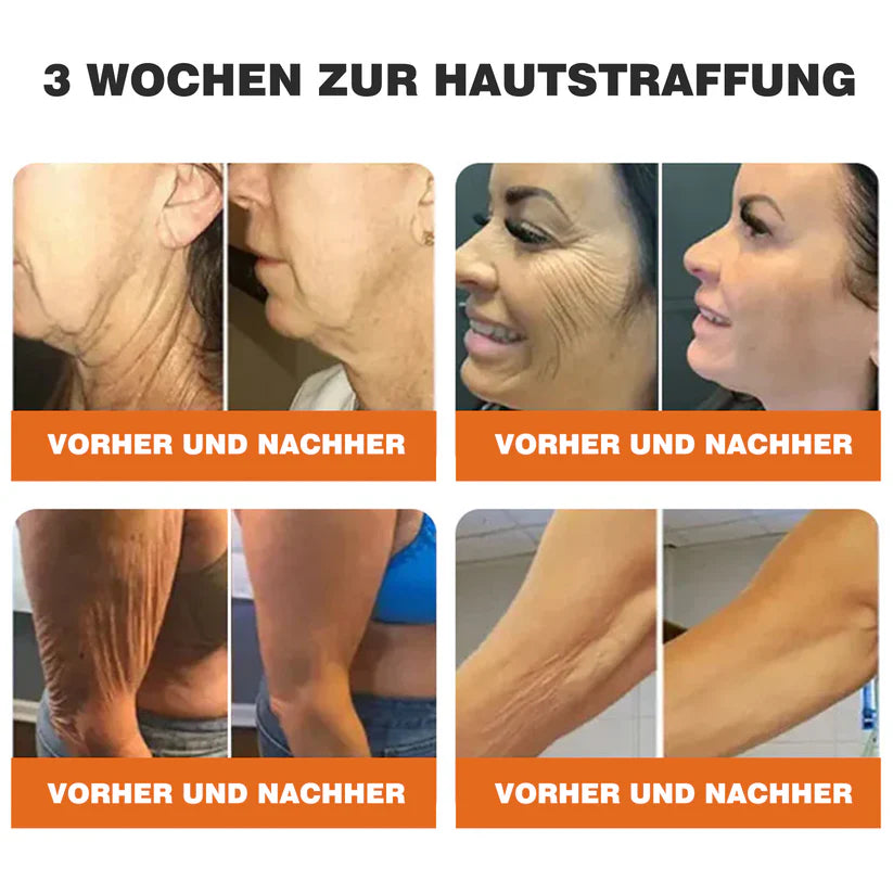 🔥Ourlyard® Bee Venom Pro Comprehensive Cream — 🔥Limited Time 80% OFF🔥