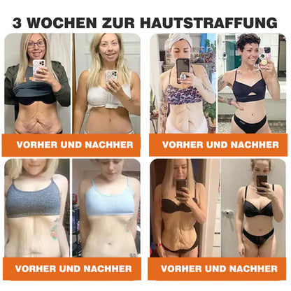 🔥Ourlyard® Bee Venom Pro Comprehensive Cream — 🔥Limited Time 80% OFF🔥