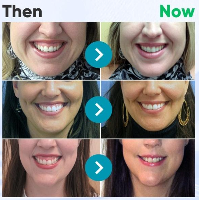 ⭐️Rolimey® VioCore toothpaste with bee venom for dental treatment