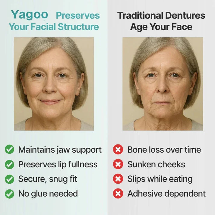 🌎Ends Today: 70% OFF! ⏰Yagoo™ Medical Full Denture with Strong Suctiond🦷Obtain American Dental Association (ADA) Certification