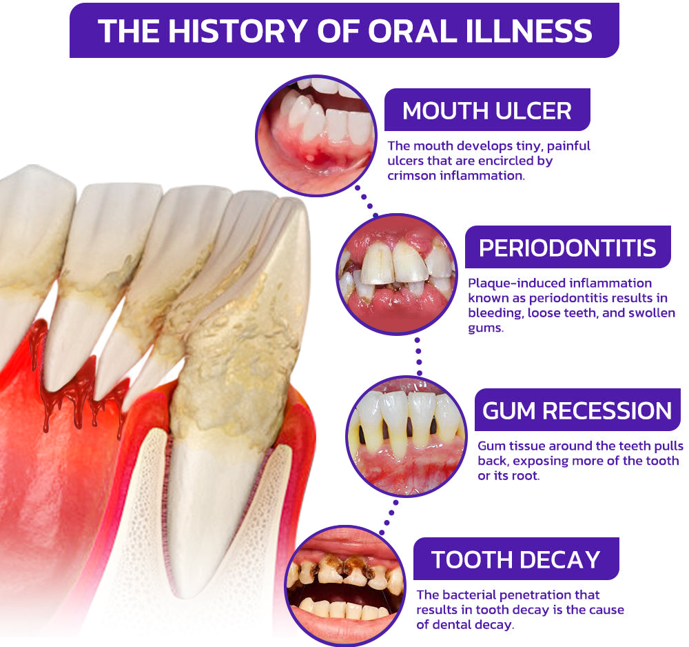 ⭐️Rolimey® VioCore toothpaste with bee venom for dental treatment